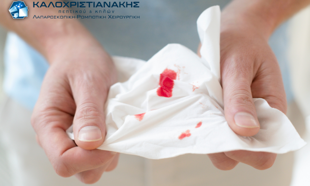 Ιατρική απεικόνιση αιμορροΐδων και αιμορραγίας από το κατώτερο πεπτικό