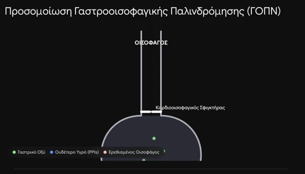 Προσομοίωση γαστροοισοφαγικής παλινδρόμησης με τον οισοφάγο και τον καρδιοοισοφαγικό σφιγκτήρα